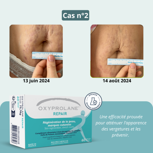 Oxyprolane® Repair - Régénération de la peau, vergetures – Image 6