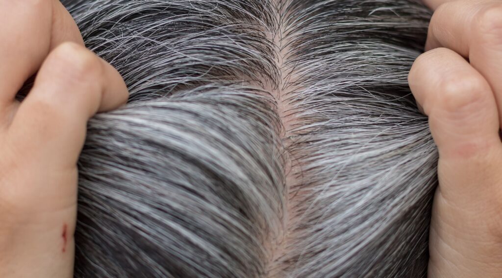 Révolutionnez Votre Chevelure : Dites Adieu aux Cheveux Gris Sans Coloration !